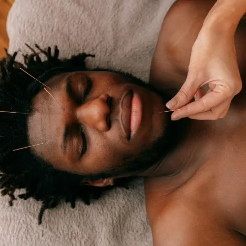 Acupuncture & Massage Combination – Ancient Healing Meets Modern Wellness